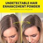 SEVICH Root Touch Up Hair Color Powder with Mirror & Brush – Instant Gray Hair Cover Up, Waterproof Sweatproof Formula, Natural Finish for Hairline & Bald Spot, 48H Long Lasting, Med Brown