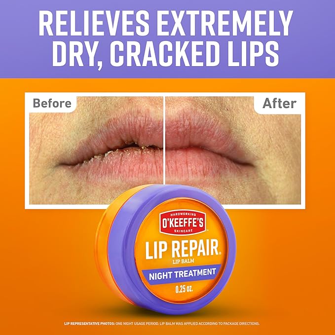 O'Keeffe's Lip Repair Night Treatment Lip Balm for Dry, Cracked Lips - 0.25 Ounce Jar (1 Pack) - Moisturizer Extremely Cracked, Dry Lips