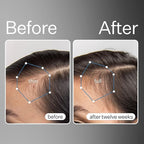 Act+Acre Cold Processed Stem Cell Scalp Serum - Promotes Thicker and Fuller-Looking Hair - Soothes and Hydrates the Scalp - Sulphate and Paraben Free - Aloe Vera for Improved Scalp Health - 1 fl oz.