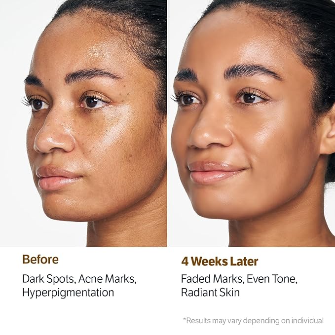 SUNGBOON EDITOR Kojic Capsule Brightening Cleanser | Low pH Gentle Gel Face Wash | Encapsulated Kojic Acid, Turmeric & Niacinamide for Dark Spots, Acne & Blackhead | Korean Skincare, Stocking Stuffers