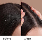 GK HAIR Anti-Dandruff Shampoo Leaving Your Scalp Refreshed and Hair Soft, Smooth – Sulfate-Free Shampoo for Dry Damaged Hair for Men and Women 8.5 Fl Oz