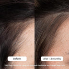 BondiBoost HG Anti-Thinning Shampoo Conditioner Set [10.14 fl oz each], Clinically Tested to Promote Fuller + Thicker-Looking Hair for Women & Men, Procapil, Redensyl & Rosemary Formula, Sulfate-Free