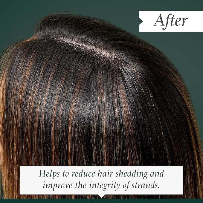 Philip Kingsley | Density Preserving Scalp Foam | Treatment Volumising for Thinning Hair and Hair Loss | Fine, Flat, Thin Hair Volumizer Lifting Foam | Helps Add Texture and Lift Roots | 4.05oz