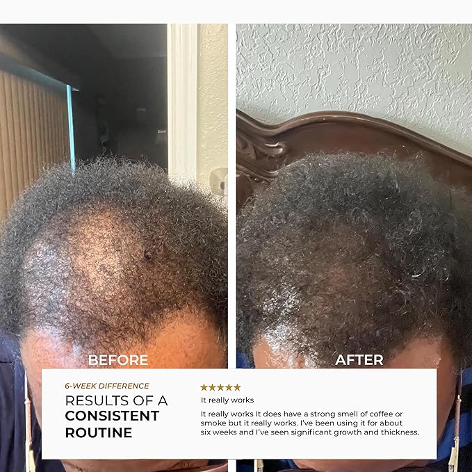 Unrefined Batana Oil for Hair Growth - 100% Raw Unrefined Batana Oil from Honduras - Dr. Sebi Approved Pure Hair Treatment for Thicker Hair - 4oz