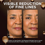 L'Oreal Paris Age Perfect Anti-Aging Midnight Face Serum, Reduce Wrinkles 1oz + Eye Cream Sample