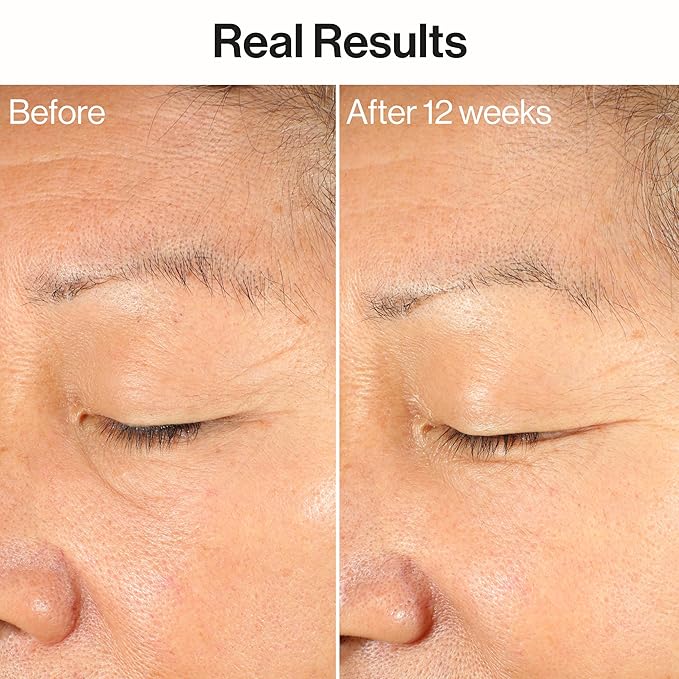 Honest Beauty Ageless Firm and Even Serum, Powered by Vegan Collagen Elastin Polypeptides, Firmer-Looking Skin, Fragrance Free, EWG Verified, Cruelty-Free, 1 fl oz