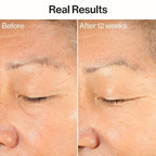 Honest Beauty Ageless Firm and Even Serum, Powered by Vegan Collagen Elastin Polypeptides, Firmer-Looking Skin, Fragrance Free, EWG Verified, Cruelty-Free, 1 fl oz