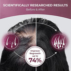 PUREHEALTH RESEARCH ReGrow - Hair Growth Vitamins - with Saw Palmetto, Biotin, Collagen, Zinc, Iron, Iodine, Selenium & More - Hair Supplements for Women & Men - 60 Capsules