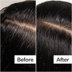 ACT+ ACRE Cold Processed Scalp Detox Oil - Sulfate-Free Care for Flaky, Dry and Itchy Scalp - Promotes Thicker, Fuller-Looking Hair