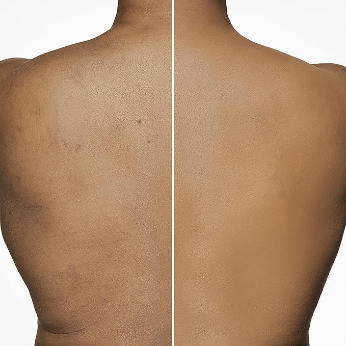 Dermablend Leg and Body Makeup Foundation with SPF 25, 40W Medium Golden, 3.4 Fl. Oz.