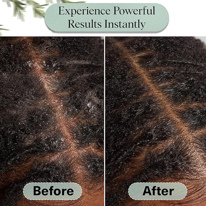 Kitsch Rosemary Oil for Hair Growth – Hair Oil with Biotin, Castor & Jojoba – Pre-Wash Scalp oil for Hair Care – Lavender Scent – 10mL | Ideal Gifts for Women