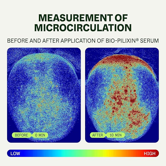 Scandinavian Biolabs Bio-Pilixin® Hairline Booster | Hair Activation Formula with a Massaging Applicator, For Hairline Longevity, Vegan, 15 mL/ 0.5 oz