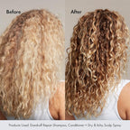 BONDIBOOST Anti-Dandruff Repair Shampoo; Soothe and Revitalize Your Scalp - Relief for Itchy, Flaky, and Irritated Scalp, Promotes Healthy Hair and Long-Lasting Comfort