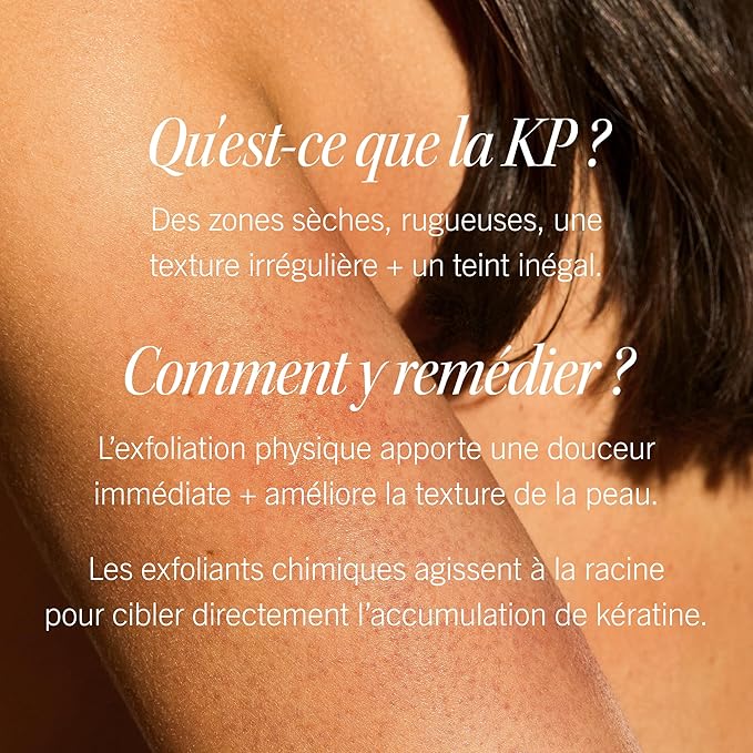 First Aid Beauty KP Bump Eraser Body Scrub with 10% AHA, Keratosis Pilaris Skin Exfoliator with Glycolic and Lactic acids, Helps Reduce Chicken Bumps, Safe for Sensitive Skin, 8 oz