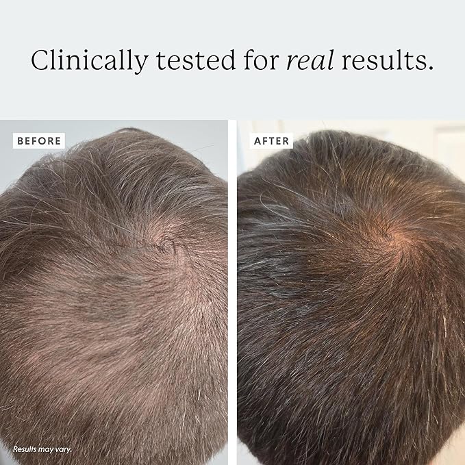 Densifying Scalp Serum, 1 fl oz, with Procapil and Redensyl