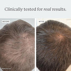 Densifying Scalp Serum, 1 fl oz, with Procapil and Redensyl