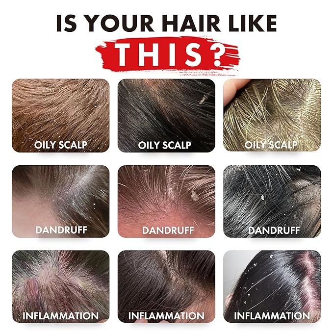 ALFHEIM Rosemary+ Purifying Shampoo – Clarifying Cleanse for Oily & Fine Hair with Rosemary, Peppermint & Jojoba Oils – Deep Scalp Refresh, Lightweight Volume – Vegan, Sulfate Free – 18 oz / 535 ml