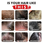 ALFHEIM Rosemary+ Purifying Shampoo – Clarifying Cleanse for Oily & Fine Hair with Rosemary, Peppermint & Jojoba Oils – Deep Scalp Refresh, Lightweight Volume – Vegan, Sulfate Free – 18 oz / 535 ml