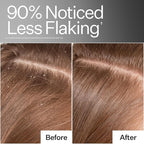 ACT+ ACRE Cold Processed Scalp Detox Oil - Sulfate-Free Care for Flaky, Dry and Itchy Scalp - Promotes Thicker, Fuller-Looking Hair