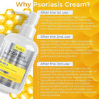Psoriasis Cream for Itchy Scalp, Face & Body | Eczema Cream for Adults | Psoriasis Treatment for Skin | Itching, Irritation & Redness Relief | XL Size