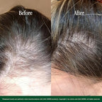 Hair Oil Mask Pre-Wash & Overnight 100% Natural Hair Growth Oil with Cold Pressed Argan, Castor, Jojoba, Rosemary, Vitamin E (8.45 Fl Oz)