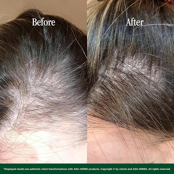 Hair Oil Mask Pre-Wash & Overnight 100% Natural Hair Growth Oil with Cold Pressed Argan, Castor, Jojoba, Rosemary, Vitamin E (8.45 Fl Oz)